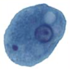 <p>What Amebae is this? Is this the trophozoite or cyst form?</p>