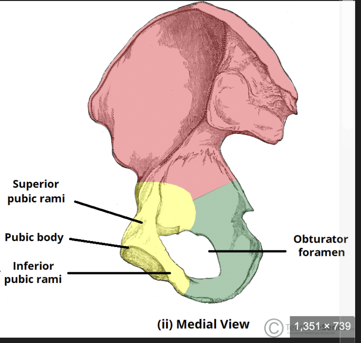 <p>The inferior pubic ramus extends laterally and joins the ischial ramus (green)</p>