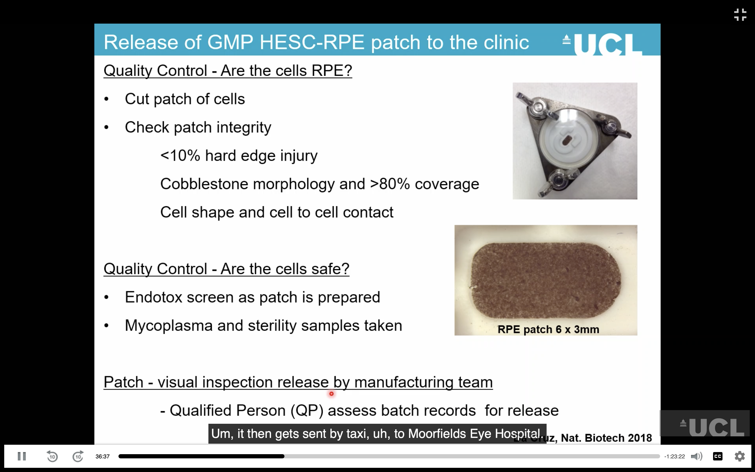 <ul><li><p><strong>Safety testing:</strong> confirmed the differentiated RPE cells did not form <strong>teratomas</strong>; undifferentiated embryonic stem cells did.</p></li><li><p><strong>GMP manufacturing:</strong> cells were differentiated, expanded and grown on the membrane under <strong>Good Manufacturing Practice (GMP)</strong> conditions.</p></li><li><p>The final patch was only <strong>3 × 6 mm</strong>, enough to cover the macula/foveal region.</p></li><li><p>A specialised <strong>surgical delivery tool</strong> was developed to roll the patch up, place it under the retina and safely release it.</p></li><li><p><strong>MHRA and ethics approval</strong> were required before clinical trials; approval took about <strong>4 years</strong>.</p></li></ul><p></p>