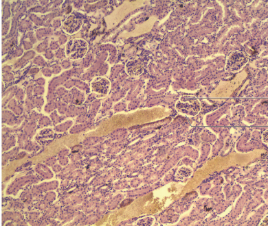 <p>this is a picture of?</p><p></p><p>labels?</p><p>bowmans space</p><p>glomerulus</p>