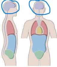 <p>division of the posterior cavity that houses the brain</p>