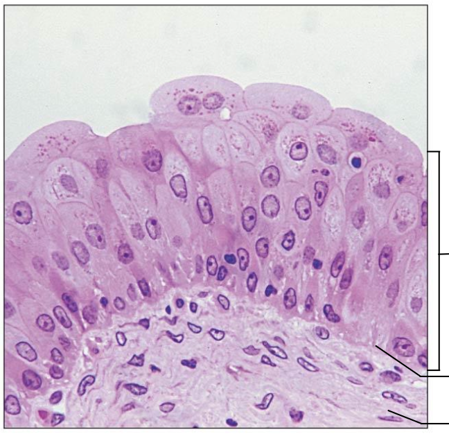 <p>Transitional epithelium description:</p>