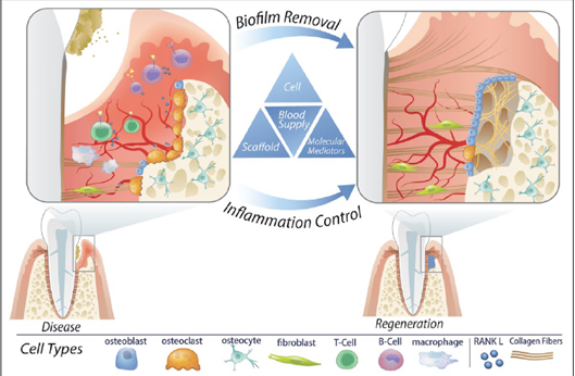 <p>-optimal goal of periodontal therapy</p><p>-procedures are only an option in certain periodontal defects</p>