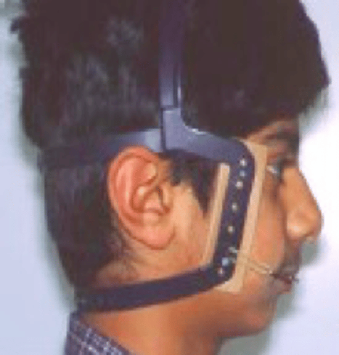 <p>ID the device:</p>
