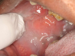 <p>ID the anatomic variant:</p>
