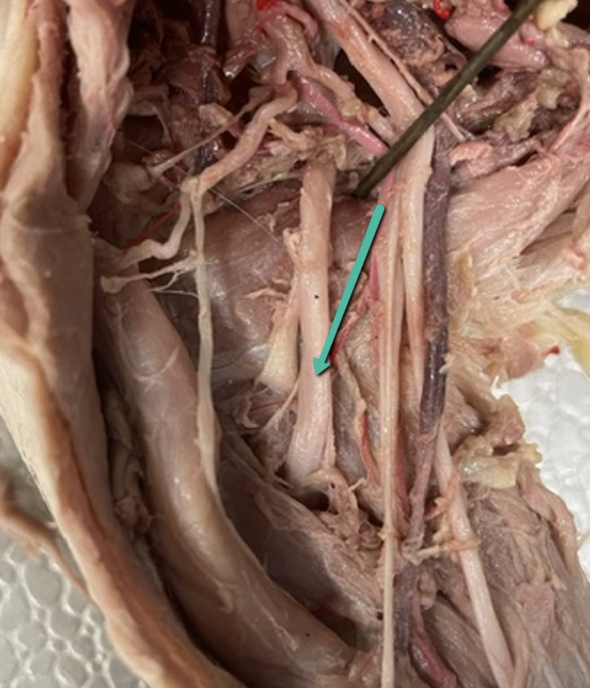 <p><span>Identify the nerve/cord indicated by the pointer.</span></p>