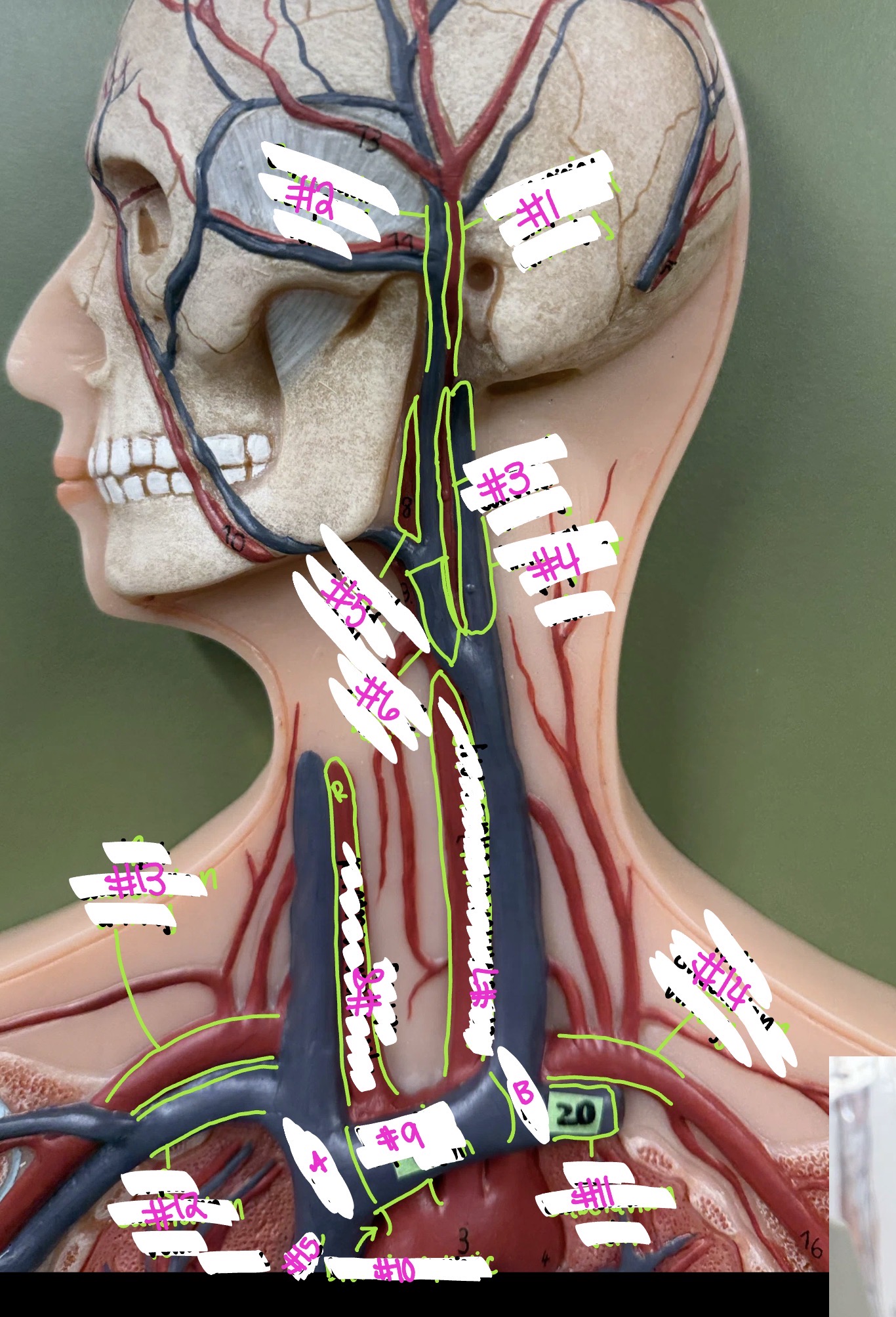 <p>what vessel is labeled #4? (head + neck vessel)</p>