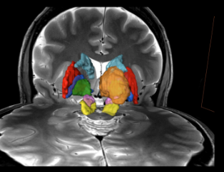 <p>Locate the structures that make up the basal ganglia</p>