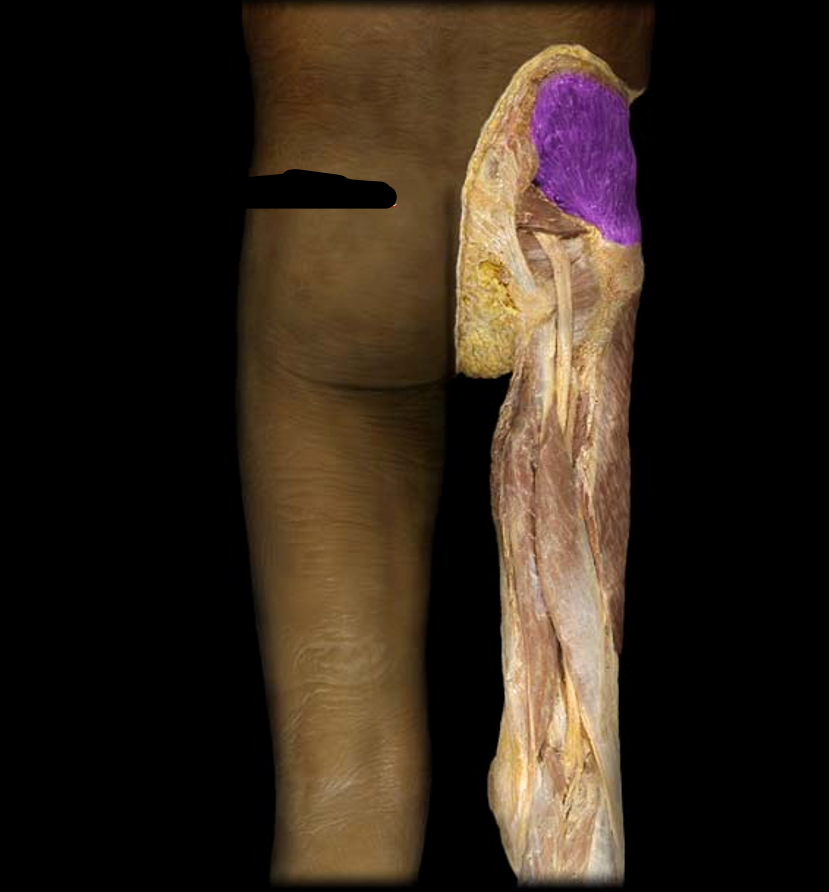 <p>What muscle is this?</p>