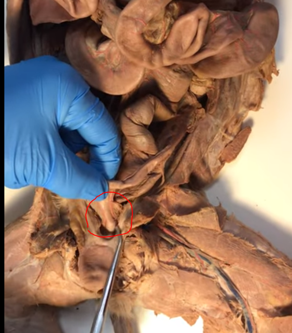 <p>What is the bump below the uterine body</p>