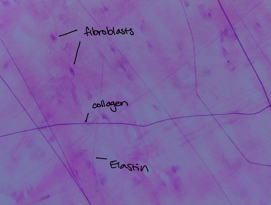 <p>Loose areolar. Collagen fibers are not packed tightly, instead a gel-like matrix that contains fibroblasts, macrophages, mast cells, and even some white blood cells. Found widely under epithelia of the body and around internal organs that don’t respond to a great deal of stress. Wraps around organs like tissue paper. Provides cushion to organs and its macrophages ingest bacteria. </p>