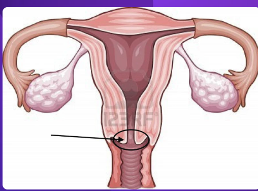 <p>what is the black arrow pointing to?</p>