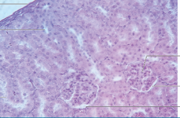 <p>this is a picture of?</p><p></p><p>word bank for labeling left down then right down:</p><p>pct microvilli</p><p>podocytes</p><p>capsular space</p><p>dct cuboidal epithelium</p><p>renal capsule</p><p>simple squamous parietal capsule</p>