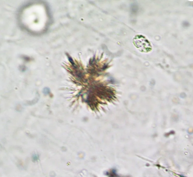 <p>Needle-shaped crystals associated with liver disease are known as</p>