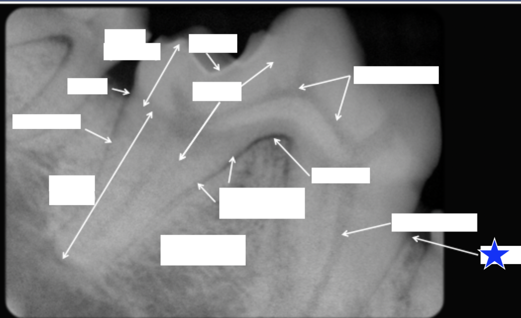 <p>What part of the tooth is indicated by the star?</p>