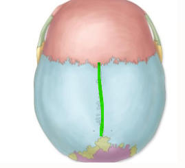 <p>What suture lies in the highlighted area? </p>