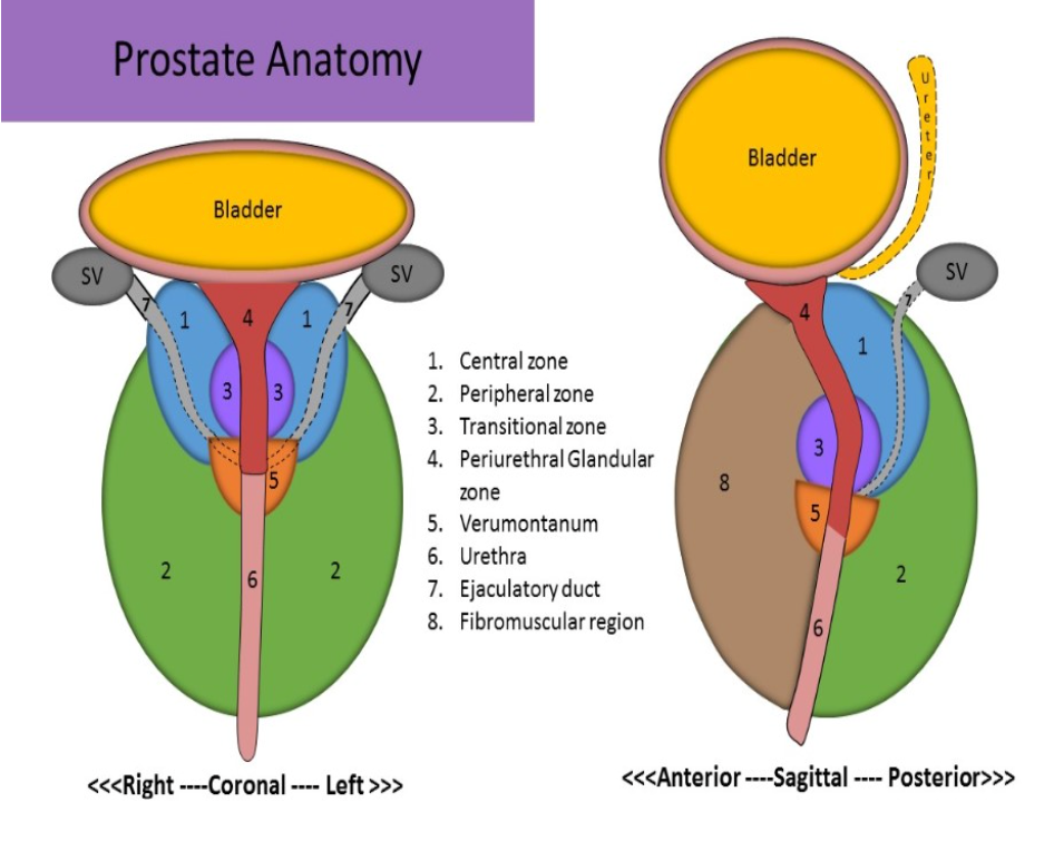 <p>A. fibromuscular region</p><p>The prostate gland contains four glandular zones and a fibromuscular region.</p><p class="p1">The peripheral zone is the largest glandular segment. Most prostate cancer occurs in the peripheral zone and is also the most common site of chronic prostatitis. </p><p class="p1">The transitional zone, the site of benign prostatic hyperplasia (BPH), surrounds the urethra. </p><p class="p1">The central zone holds most of the remaining glandular tissue. </p><p class="p1">The glandular tissue that surrounds the proximal prostatic urethra is called the periurethral glandular zone. </p><p class="p1">The anterior fibromuscular region is mostly smooth muscle and occupies about one-third of the prostate.</p>