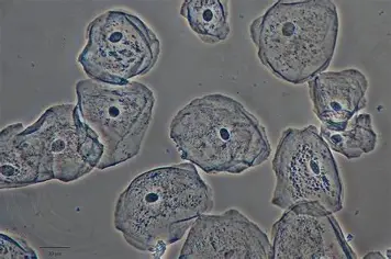 <p>Which kind of tissue is shown?</p>