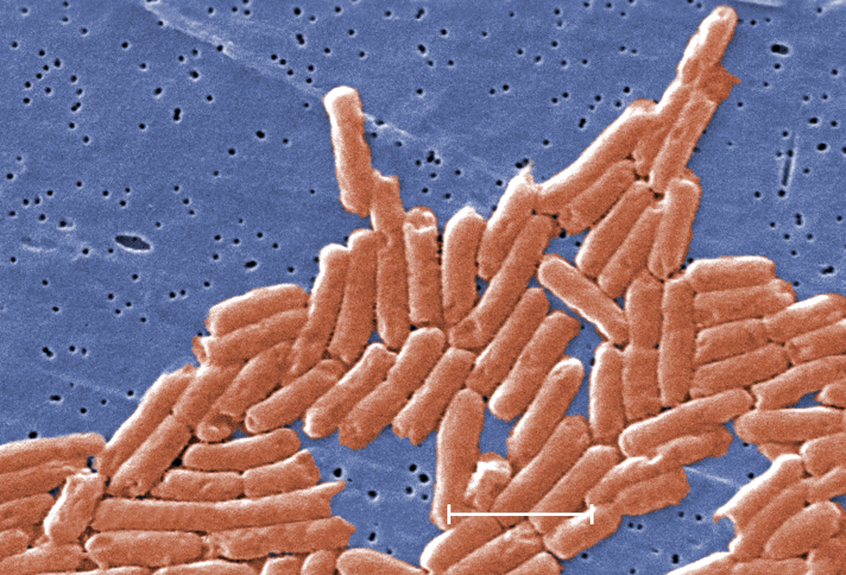<p>Salmonella</p>