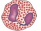 <p>Eosinophil </p>