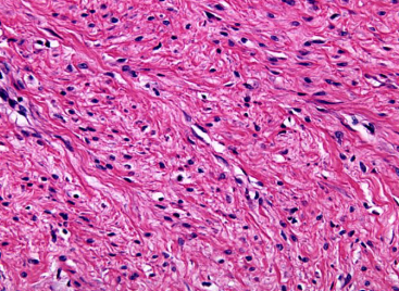 <p>What type of scar is this?</p>