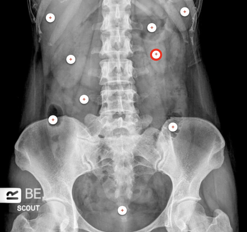 <p>what structure is the red circle labeling? </p>
