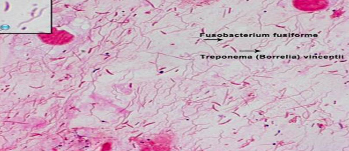 <p>Specimen (microscopically slide):</p><p>• Name of organism:</p><p>• Stain:</p><p>• Sample from: culture or pus or in tissue</p><p>• Morphology</p>