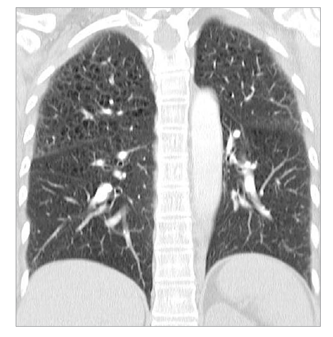 <p>What feature is seen at the top? What condition would this be?</p>