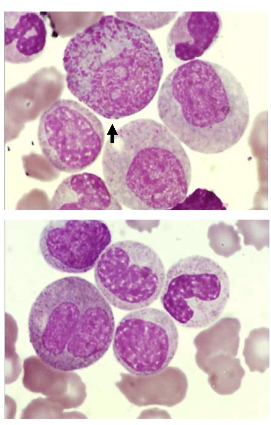 <p>Name this cell and the main points for identification</p>