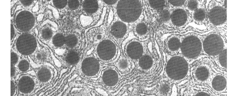 <p>Vesikels die afsnoeren van de uiteinden van de Golgi-cisternae. Verschillende types naargelang bestemming: secretievesikels (naar buiten de cel), primaire lysosomen (naar lysosomen), of vesikels voor celwandsynthese (bij planten en fungi).</p>