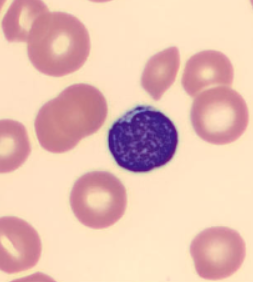 <p>nRBC or lymph?</p>