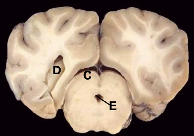 <p>E</p>