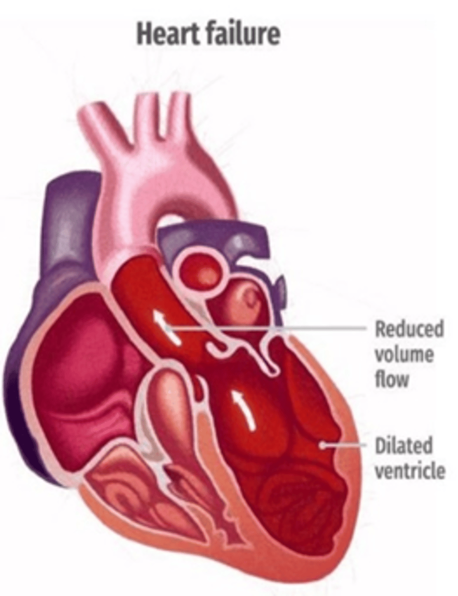 <p>A) B-type natriuretic peptide (BNP) level, Echocardiogram (monitor ejection fraction), EKG (monitor for dysrhythmias)</p>