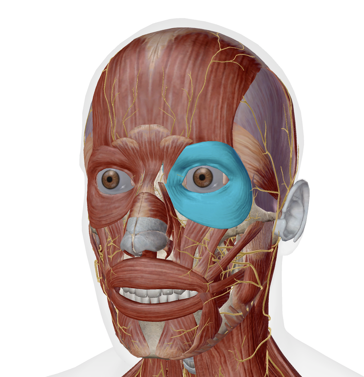 term image