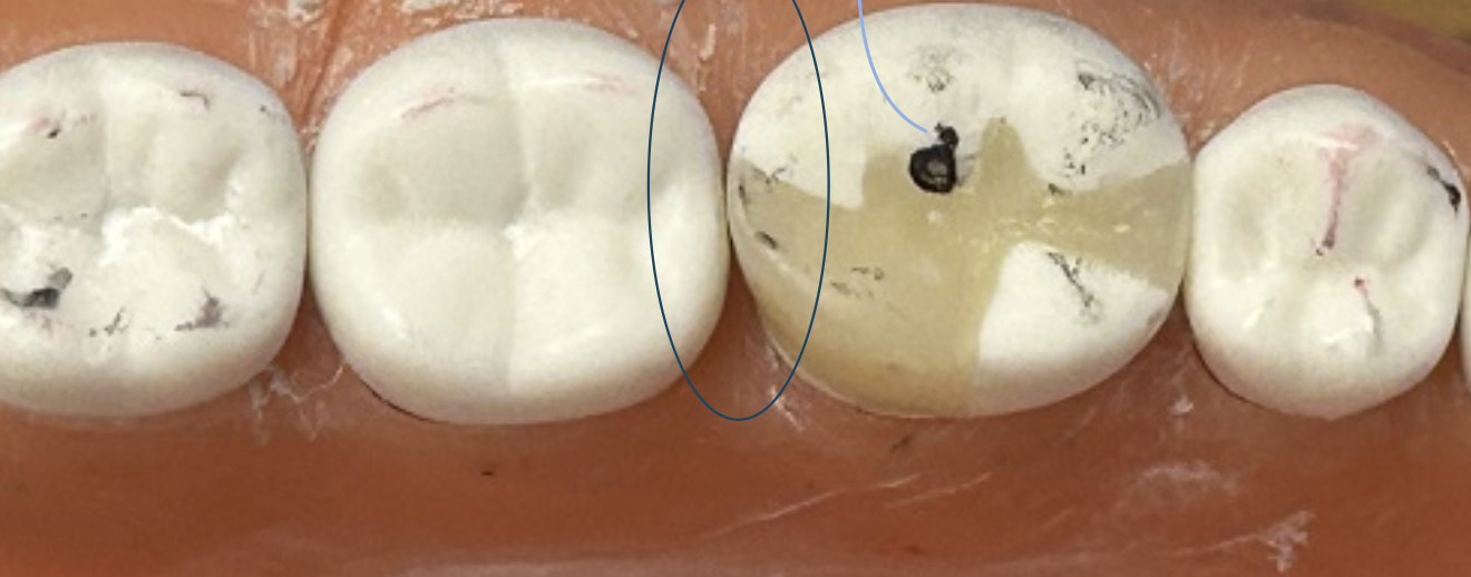 <p>Identify (2) errors with this restoration</p>