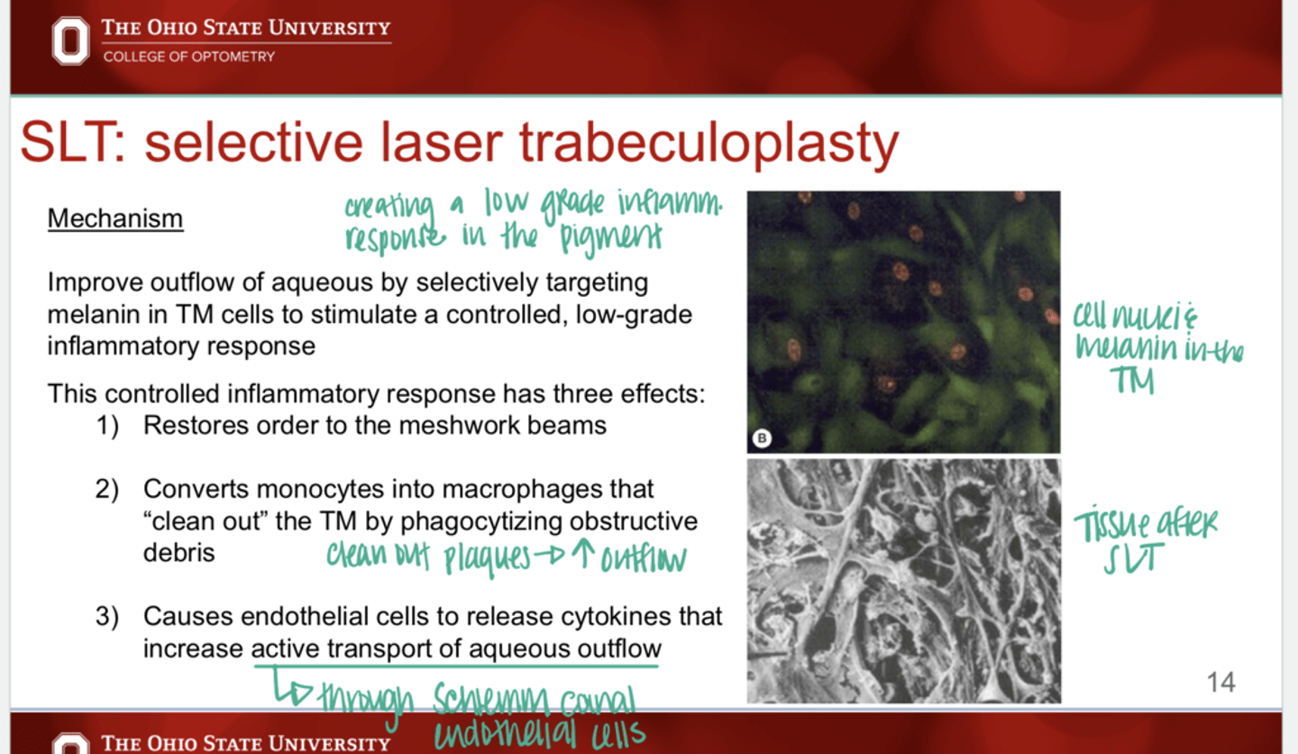 <p>What are the 3 effects of the inflammatory response that is controlled by SLT?</p>
