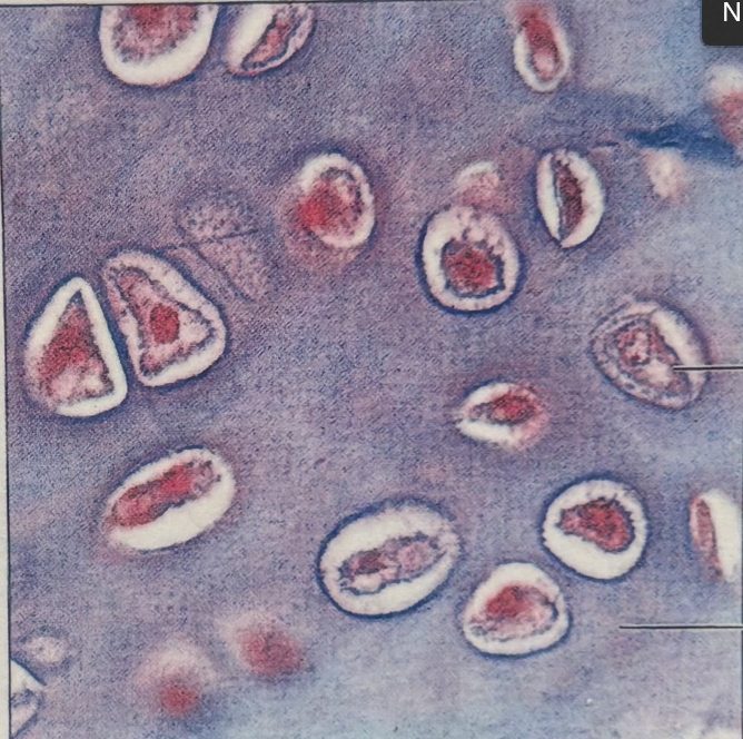 <p>hyaline cartilage</p>
