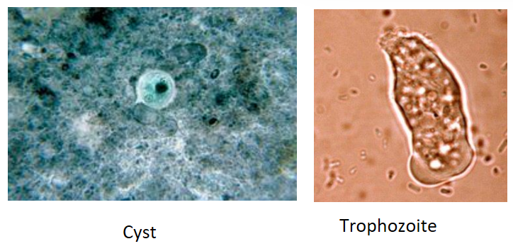 <p>Describe the<strong> Disease Symptoms</strong> of this waterborne protozoan:</p><p>-<strong>Entamoeba histolytica </strong>(<strong>Mild Disease</strong>)</p>
