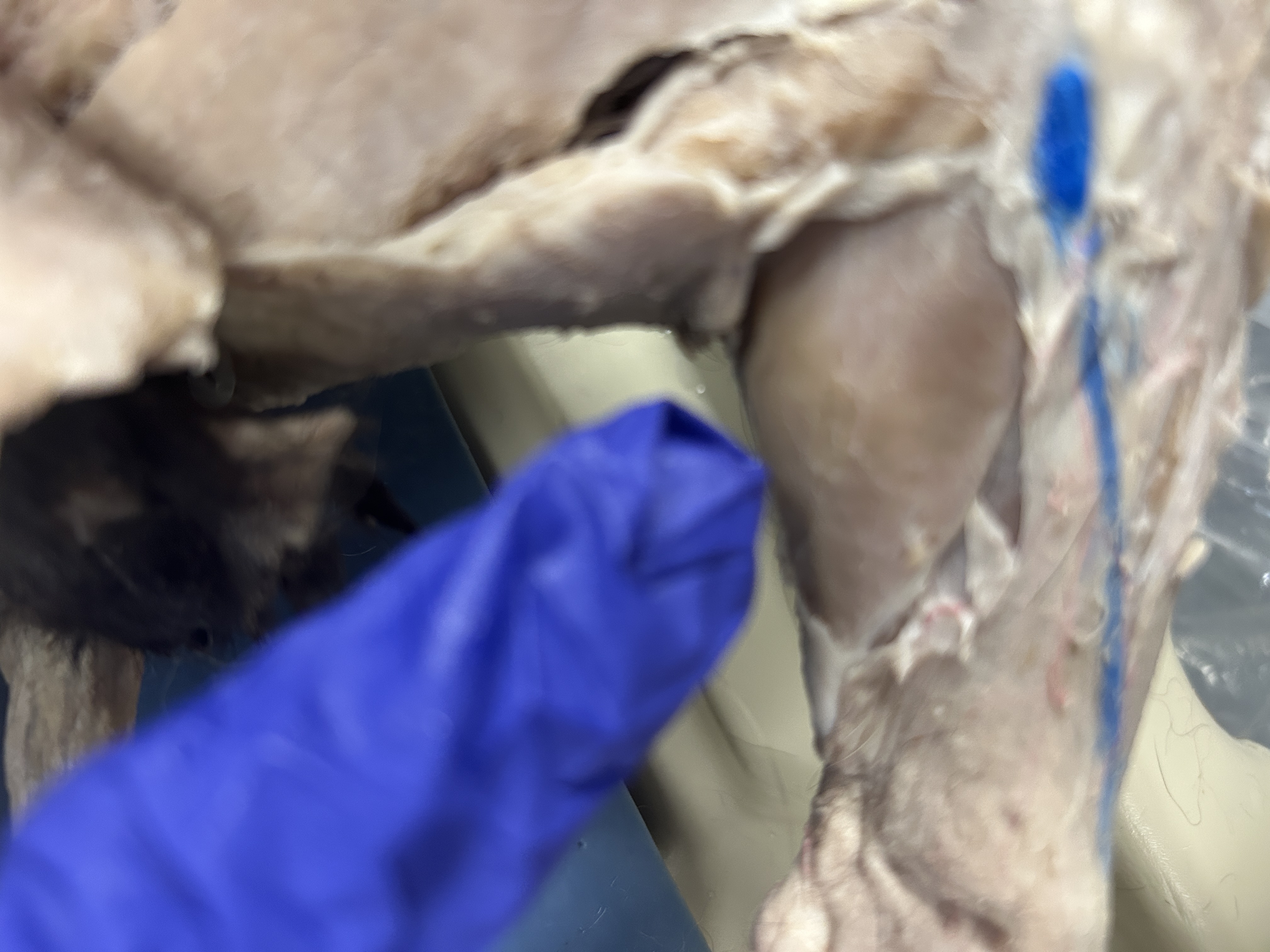 <p>Gastrocnemius(calf or under portion of leg)</p>