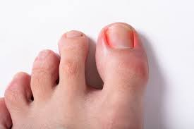 <p><span>toenail</span></p>