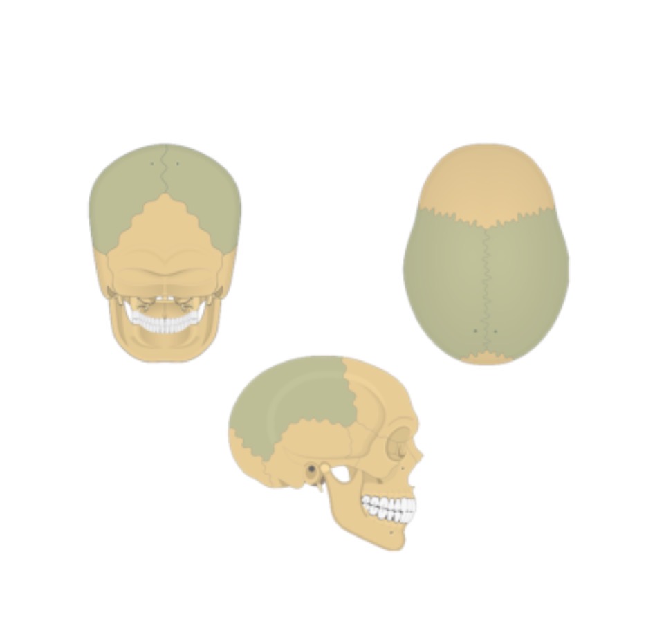 <p>Parietal bone</p>