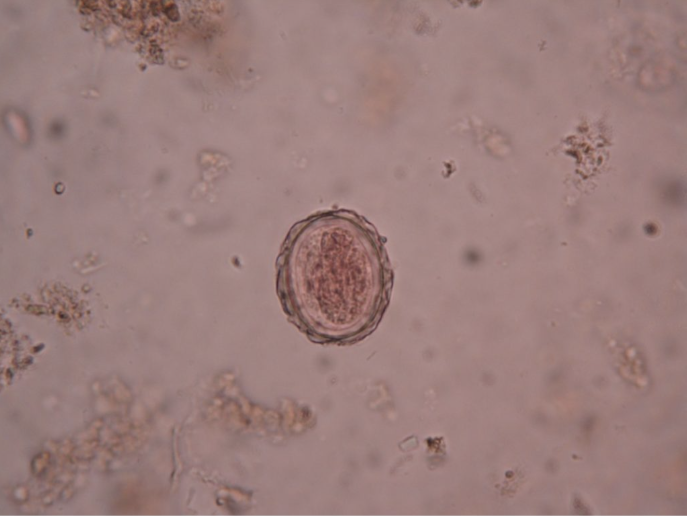 <p><span>Ascaris lumbricoides — transmission & egg ID?</span></p>