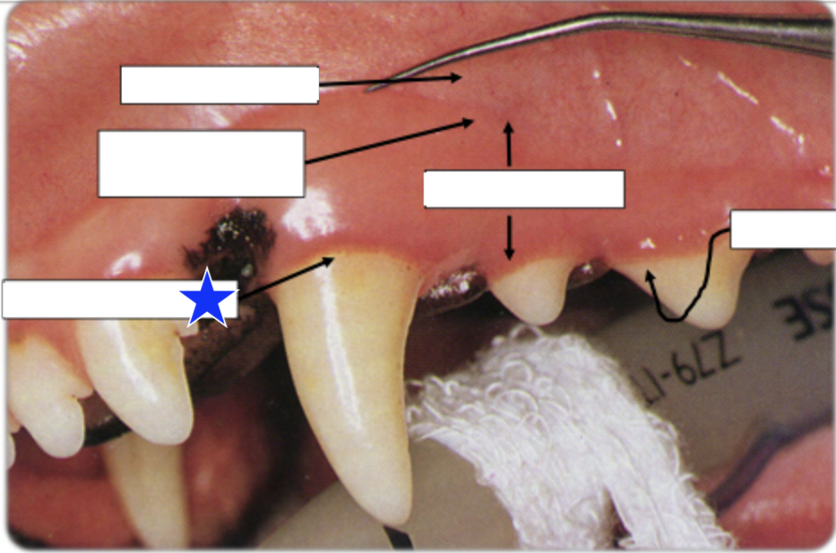 <p>What part of the gingiva is indicated by the star?</p>