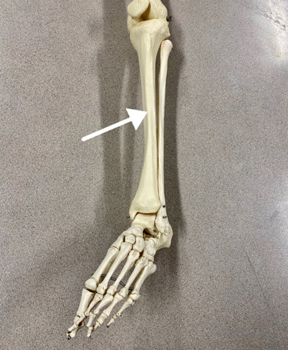 <p>What is this bone?</p>