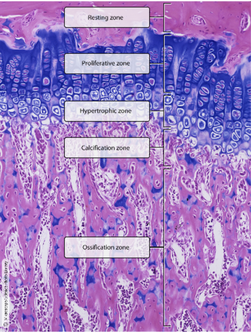 <p>(Epiphyseal plate 5 zones)</p><p>chondrocytes enlarge and the lacunae erode</p>