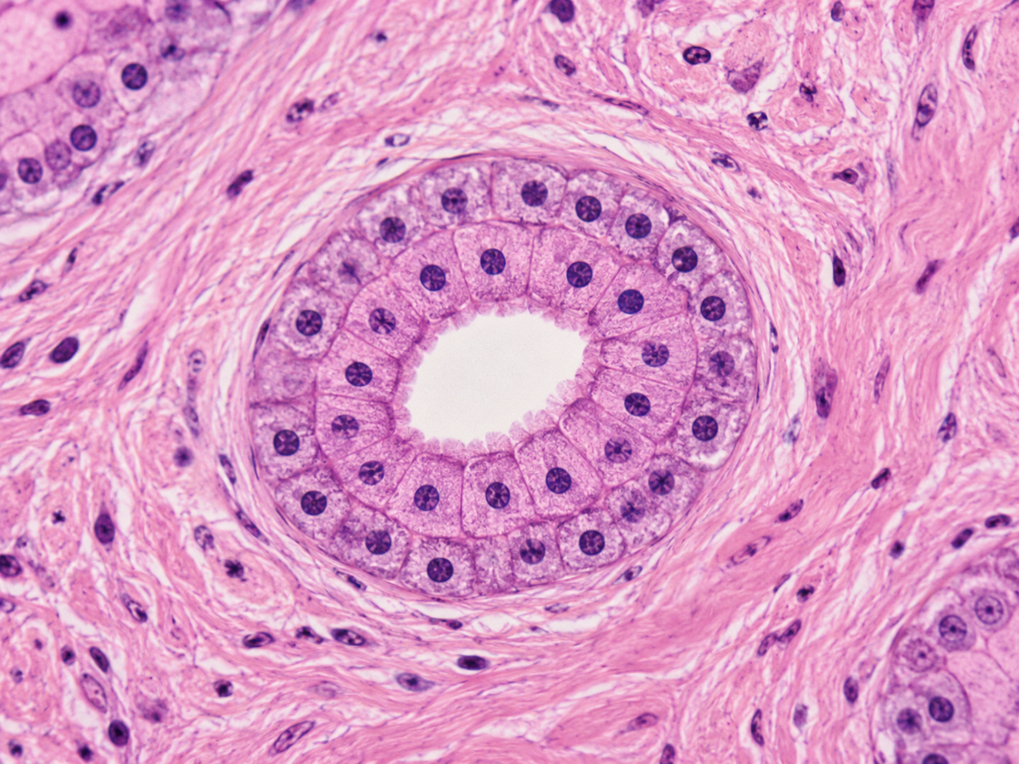 <p>What type of Epithelial Tissue is this?</p>