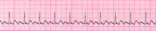 <p>what waveform is this </p>
