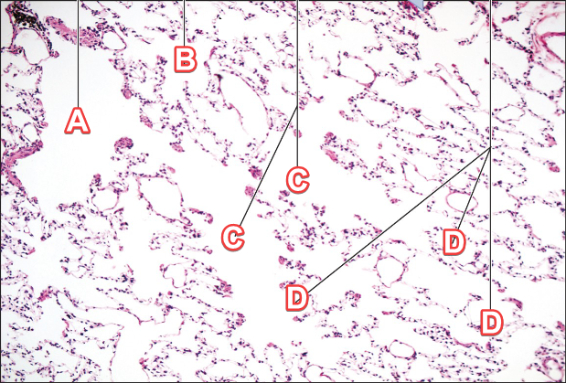 <p>In the alveolar histology slide, <strong>Label D </strong>is the</p>
