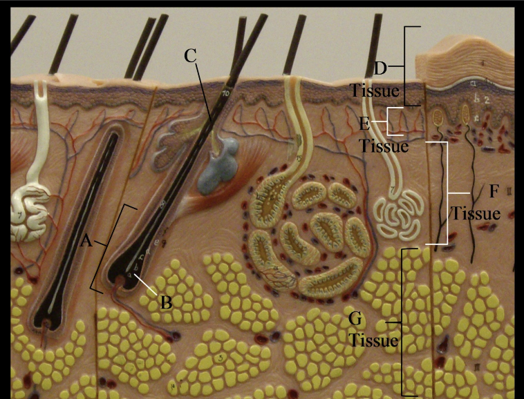 term image