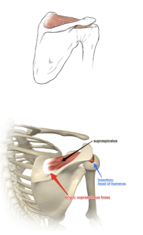 <p>What muscle is this?</p>